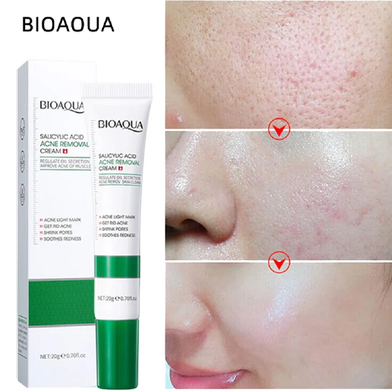BIOAQUA Salicylic Acid Acne Removal Cream