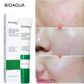 BIOAQUA Salicylic Acid Acne Removal Cream
